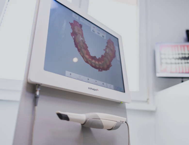 Empreinte optique numérique au cabinet dentaire du Dr Eric Salomon
